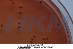 大肠埃希氏菌 O157:H7 NCTC12900 生物图册