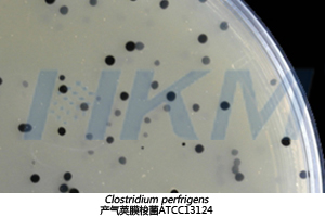 产气荚膜梭菌在SPS琼脂培养基上生长特征
