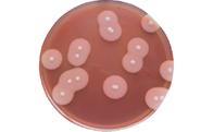 蜡样芽孢杆菌（平板计数）检验步骤及产品信息