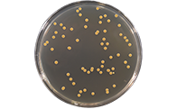 【新！】食品微生物检验GB4789.2-2022菌落总数测定及注意事项