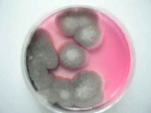 霉菌检测培养基