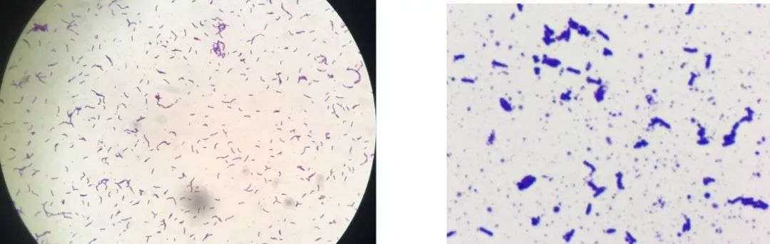 双歧杆菌在显微镜下的形态观察
