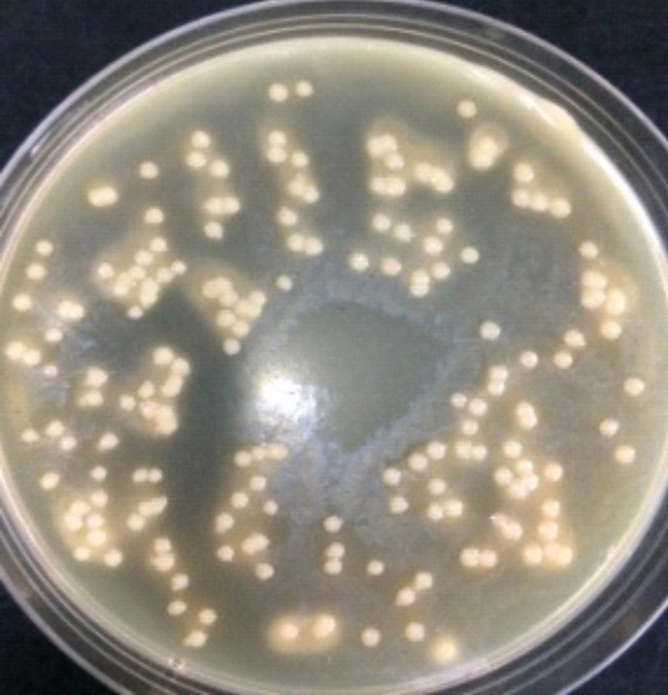 唐菖蒲伯克霍尔德氏菌在卵黄琼脂平板上的生长特征