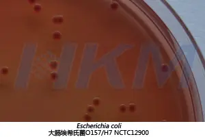 大肠埃希氏菌 O157:H7 NCTC12900 生物图册