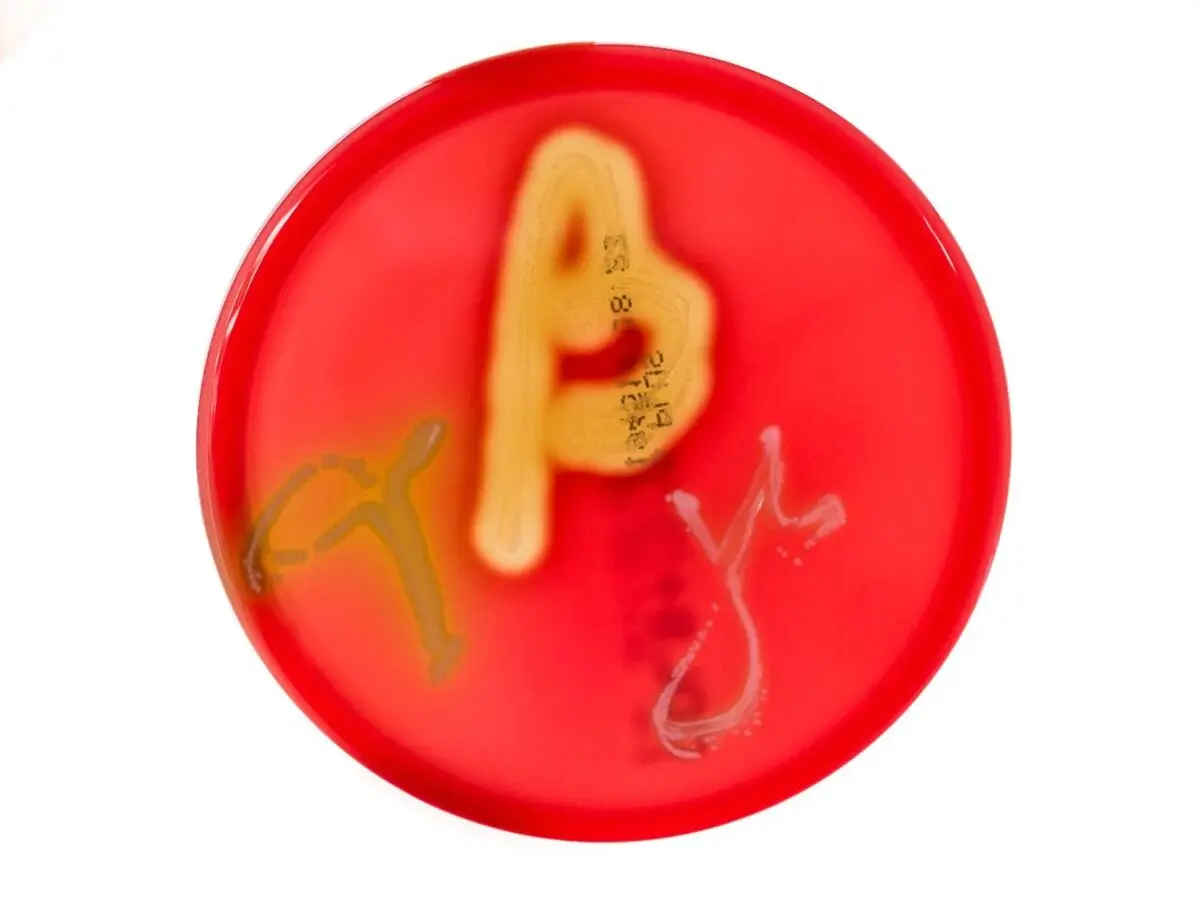 血琼脂培养显示的 α(左)、β(中)和 γ(右)溶血 血琼脂培养显示的 α(左)、β(中)和 γ(右)溶血