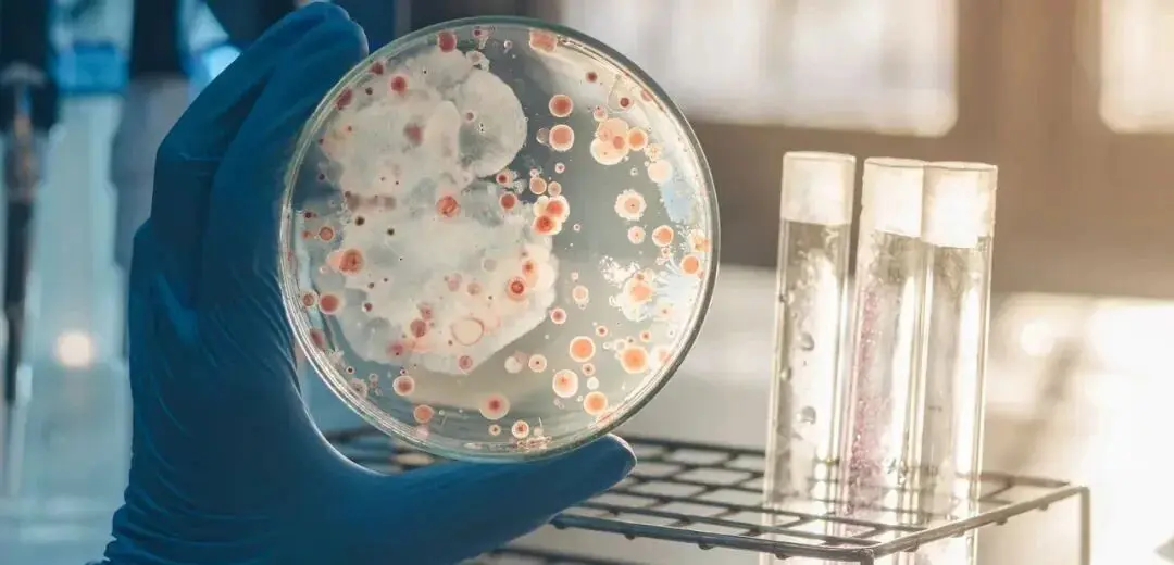 细菌培养 细菌培养