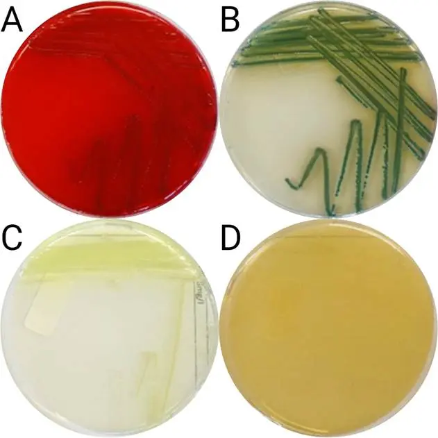菌株4在不同琼脂平板上的形态学,含亚米佩南(A: M-PA-C;B:克罗玛加尔;C:CN琼脂;D:mZ-琼脂) 菌株4在不同琼脂平板上的形态学,含亚米佩南(A: M-PA-C;B:克罗玛加尔;C:CN琼脂;D:mZ-琼脂)