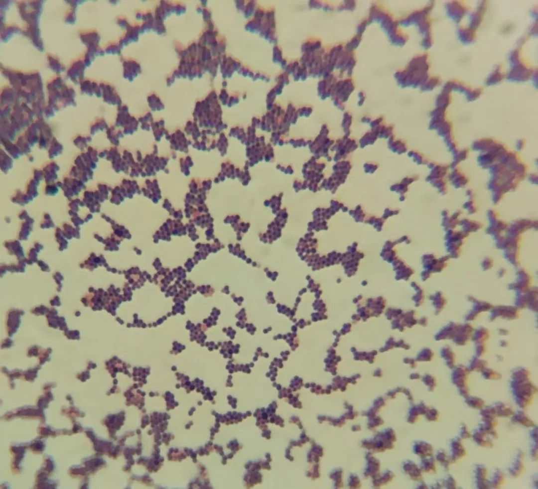 金黄色葡萄球菌（革兰氏阳性菌）的镜检图片