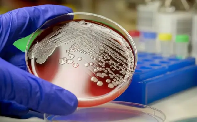 检验科微生物实验室从0到1的过程分享 检验科微生物实验室从0到1的过程分享