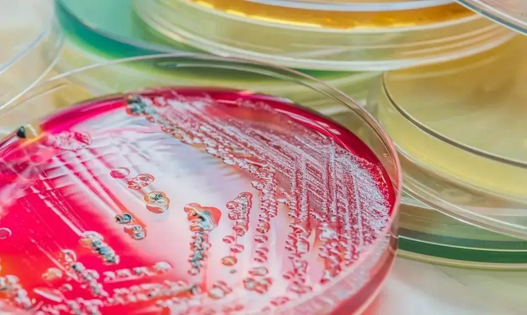 细胞培养基选择及检测