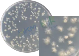置厌氧条件下培养 48～72 小时，菌落直径2-6mm，中部凸起，白色到淡黄色，具有灰色，假根状、半透明，表面无光泽