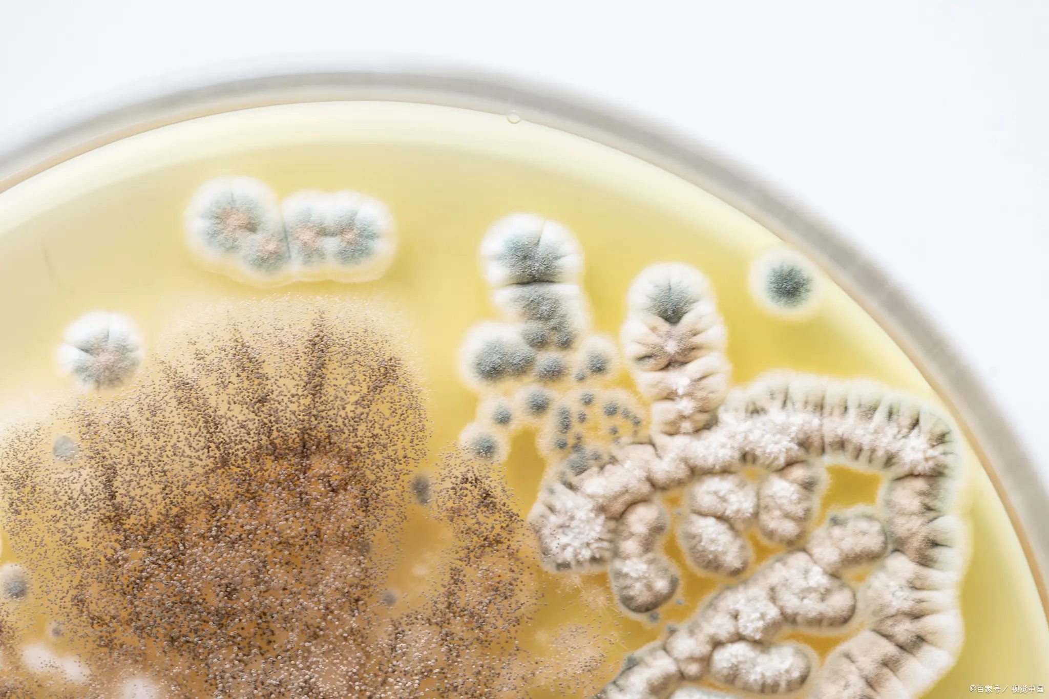 霉菌酵母菌检验常见问题 霉菌酵母菌检验常见问题