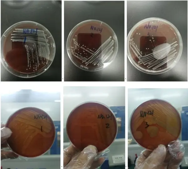 血平板(溶血观察) 血平板(溶血观察)