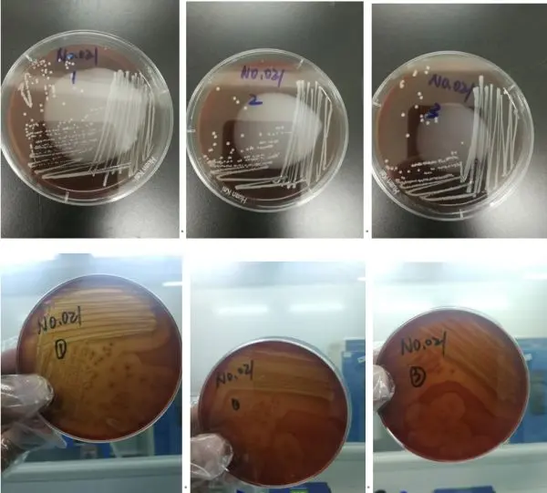 1号样品溶血情况