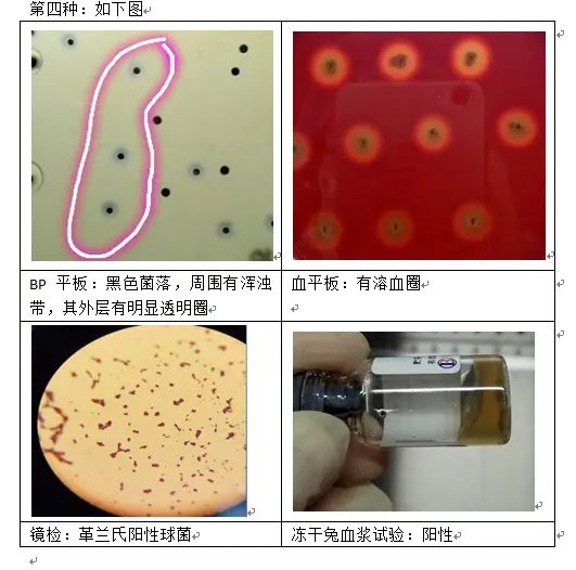 金黄色葡萄球菌在BP平板上的形态