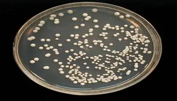 培养后计数结果超标