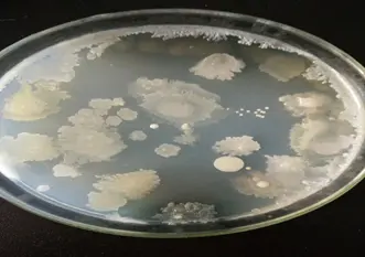 培养基平皿表面水珠凝聚