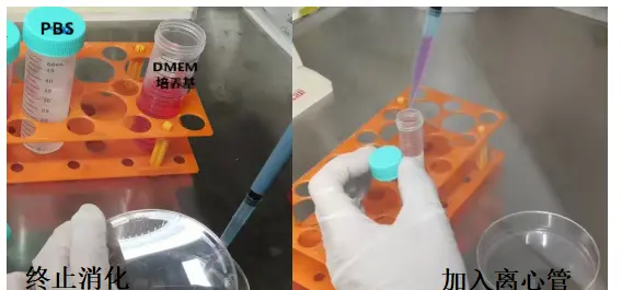 1-2min后,用含10%血清的DMEM培养基终止 1-2min后,用含10%血清的DMEM培养基终止