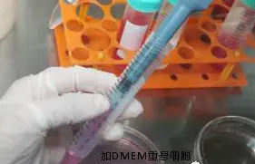 弃上清,加DMEM培养基重悬 弃上清,加DMEM培养基重悬