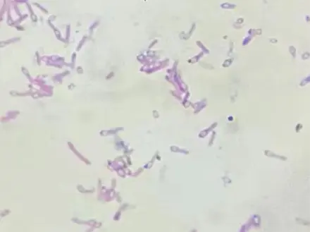 革兰氏染色 革兰氏染色