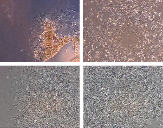 家兔阴茎海绵体平滑肌细胞（消化后植块法）