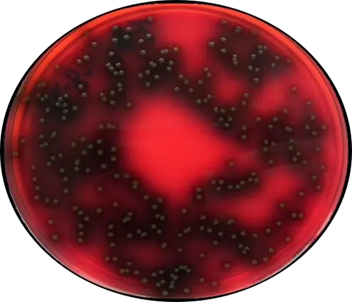 PALCAM琼脂（李斯特氏菌传统分离培养基）