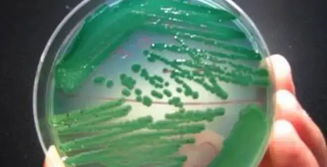 弧菌专属平板：TCBS 平板