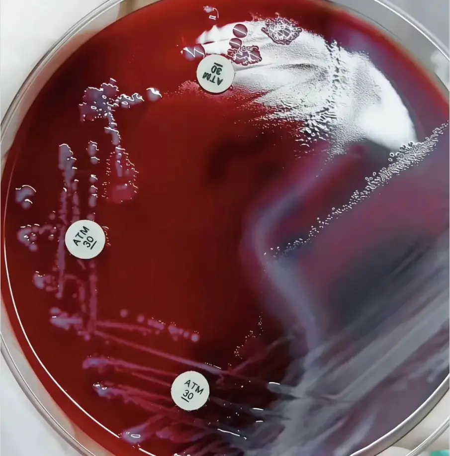 ATM(氨曲南)纸片法 ATM(氨曲南)纸片法