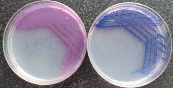 亚利桑那沙门氏菌CMCC(B)47001 (左:环凯CRM025沙门氏+显色培养基 右:常规沙门显色培养基) 亚利桑那沙门氏菌CMCC(B)47001 (左:环凯CRM025沙门氏+显色培养基 右:常规沙门显色培养基)