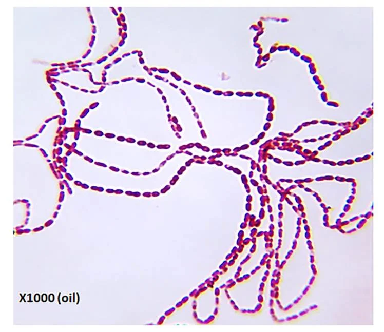莫拉氏菌Oslensis菌株YV1的革兰染色和形态学特征 莫拉氏菌Oslensis菌株YV1的革兰染色和形态学特征